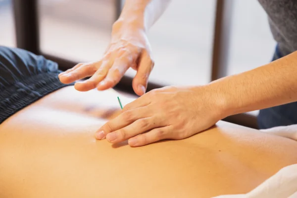 trattamento di agopuntura presso lo studio medico agopunto dott. rustichelli