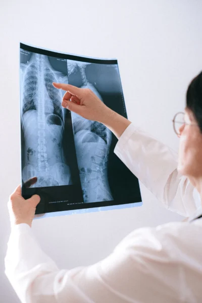 agopuntura cervicale torino rustichelli agopuntura cervicale torino rustichelli
